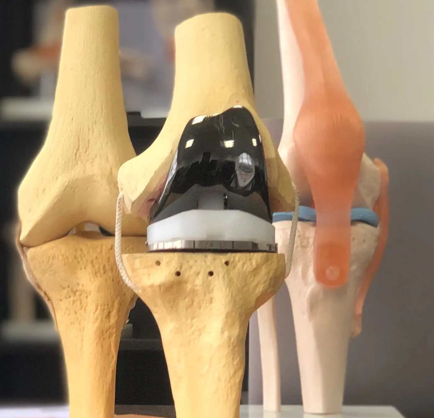 Dr. Luis Calderón con visor quirúrgico